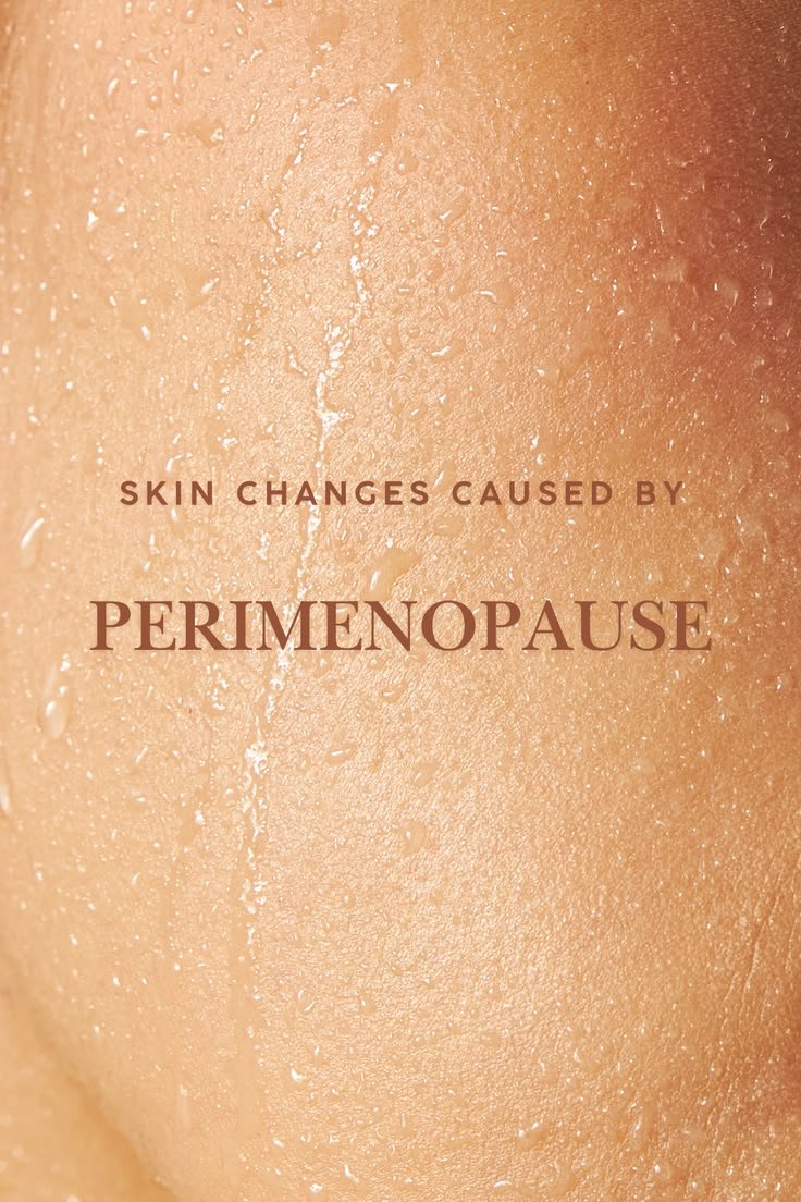 Oily skin texture showing skin changes caused by perimenopause with visible breakouts and dryness
